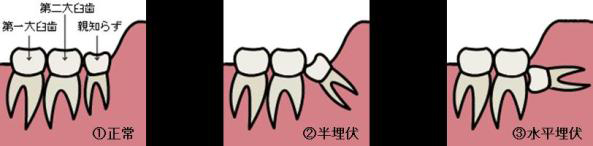 oyashirazu.jpg